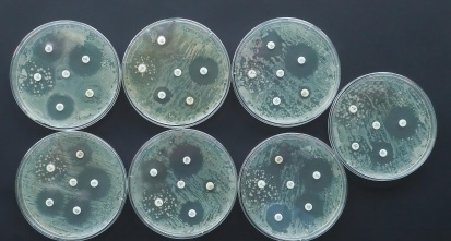 Antimicrobial susceptibility test Antibiogram Antibiotic resistance bacteria